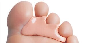 silicone orthese of teenstukje voorbeeld pedicure behandeling haarlem noord cora miltenburg